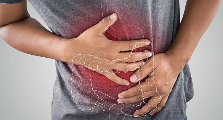 Kolon Kanserinde 10 Risk Faktörüne Dikkat
