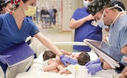 Başarıyla Ayrılan Siyam İkizleri Ülkeleri Cezayire Dönüyor