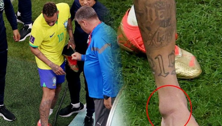Sakatlanan Neymar, Brezilya-İsviçre maçında yok