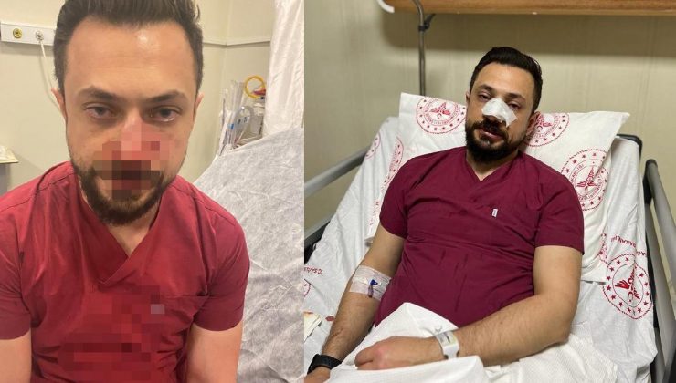 Şanlıurfa’da acil servis tabibine yumruklu atak