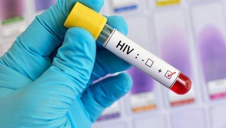 Taşova’dan ikaz: Kuşkunuz varsa 72 saat içinde başvurun, HIV olumlu olmazsınız