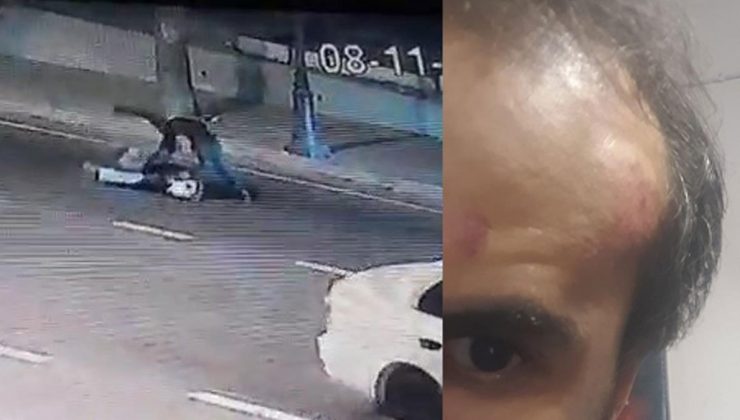 Hiç tanımadığı kişi tarafından sokakta ortasında tekme tokat dövüldü