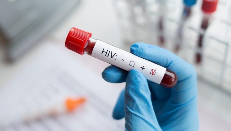 Nijerya’da 1,8 milyon kişi AIDS