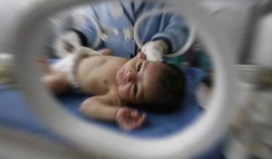 Bebeklere yer fıstığı verilmesi yer fıstığı alerjisi riskini yüzde 77 düşürebilir