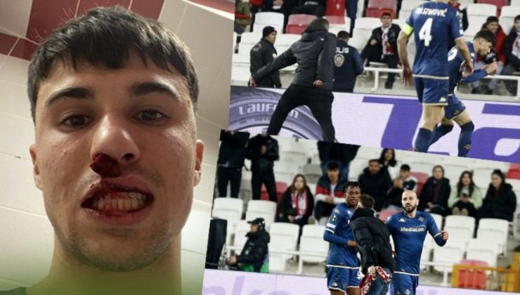 Sivasspor taraftarı Alessandro Bianco’ya saldırıp burnunu kırdı