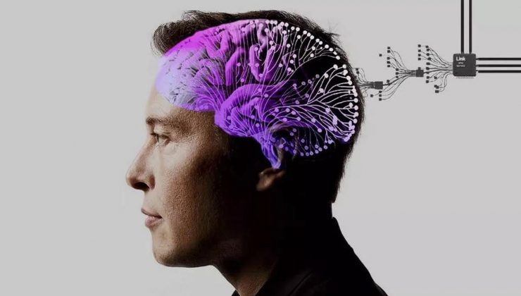 Elon Musk’ın beyin çipi firması Neuralink insan deneylerine başlıyor!