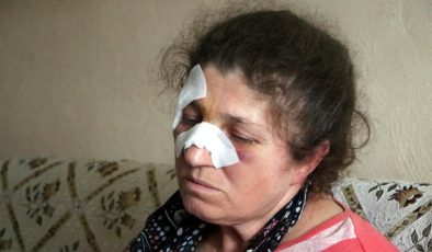 Husumetlilerinin baltalı saldırısında ağır yaralandı