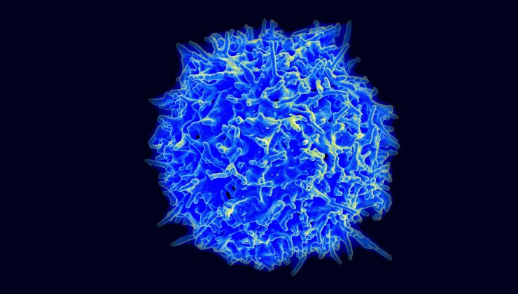 Kanseri yenen kişilerde süper “katil” T hücreleri keşfedildi