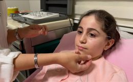 Samsun’da yüz felci geçiren 10 yaşındaki çocuk, akupunktur ile sağlığına kavuştu