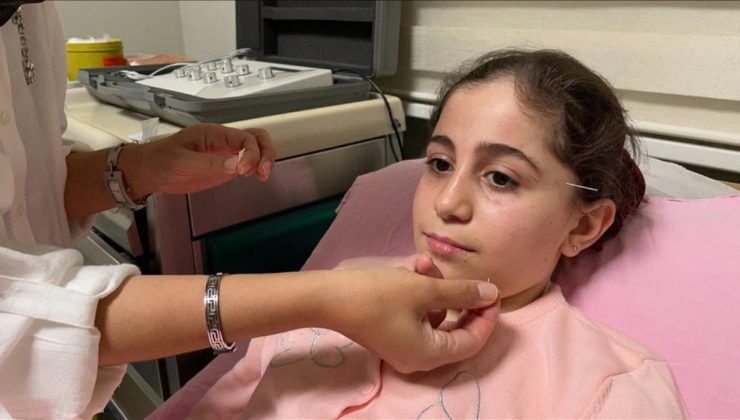 Samsun’da yüz felci geçiren 10 yaşındaki çocuk, akupunktur ile sağlığına kavuştu