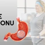 Mide Balonu Fiyatları