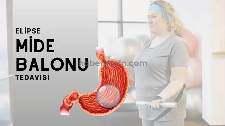 Mide Balonu Fiyatları